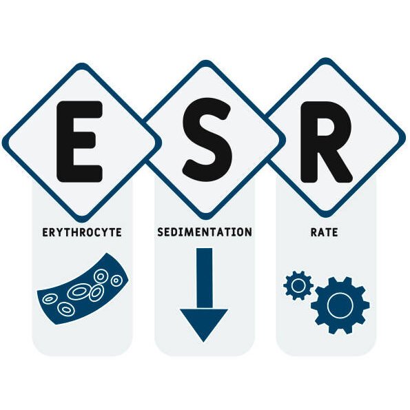 ESR