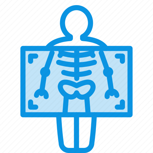 Chest X-Ray
