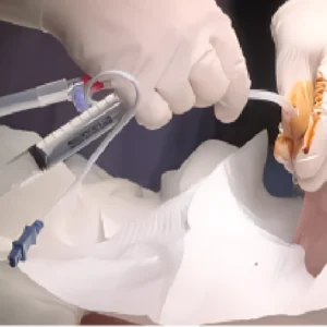 Catheter Release